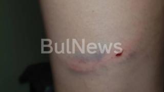 Писъци продраха Мездра, кучета сториха нещо ужасно (СНИМКИ)