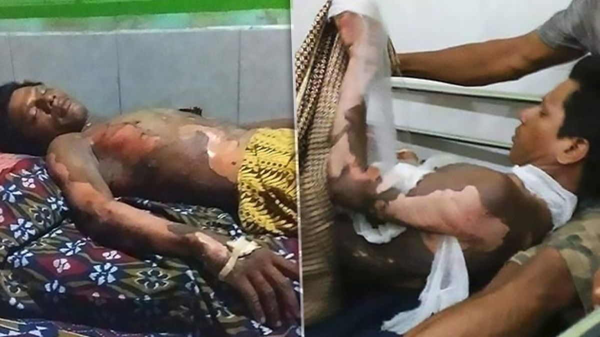 Жена поля мъжа си с бензин и го запали! Причината ще ви смае... (СНИМКИ 18+)
