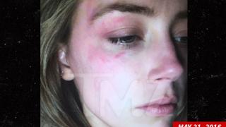 Джони Деп разкри цялата истина за побоя над Амбър Хърд