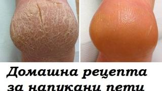 Как да се отървем от напуканите пети? Безотказна рецепта!