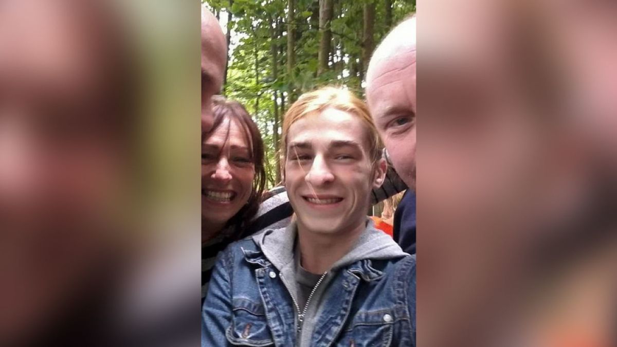 Не е за хора със слаби сърца! По-добре не гледайте тези СНИМКИ със зъбите на студент