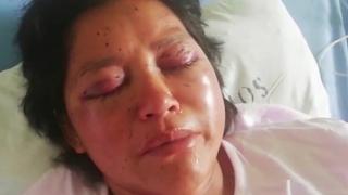 Брутално: Мъж надупчи лицето на жена си с отвертка, шокиращи СНИМКИ 18+