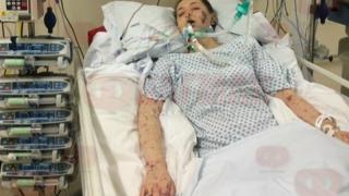 Страшна трагедия! 36-годишна жена почина след менингит в Бургас
