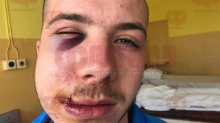 Проговори майката на зверски пребития от мутри ученик