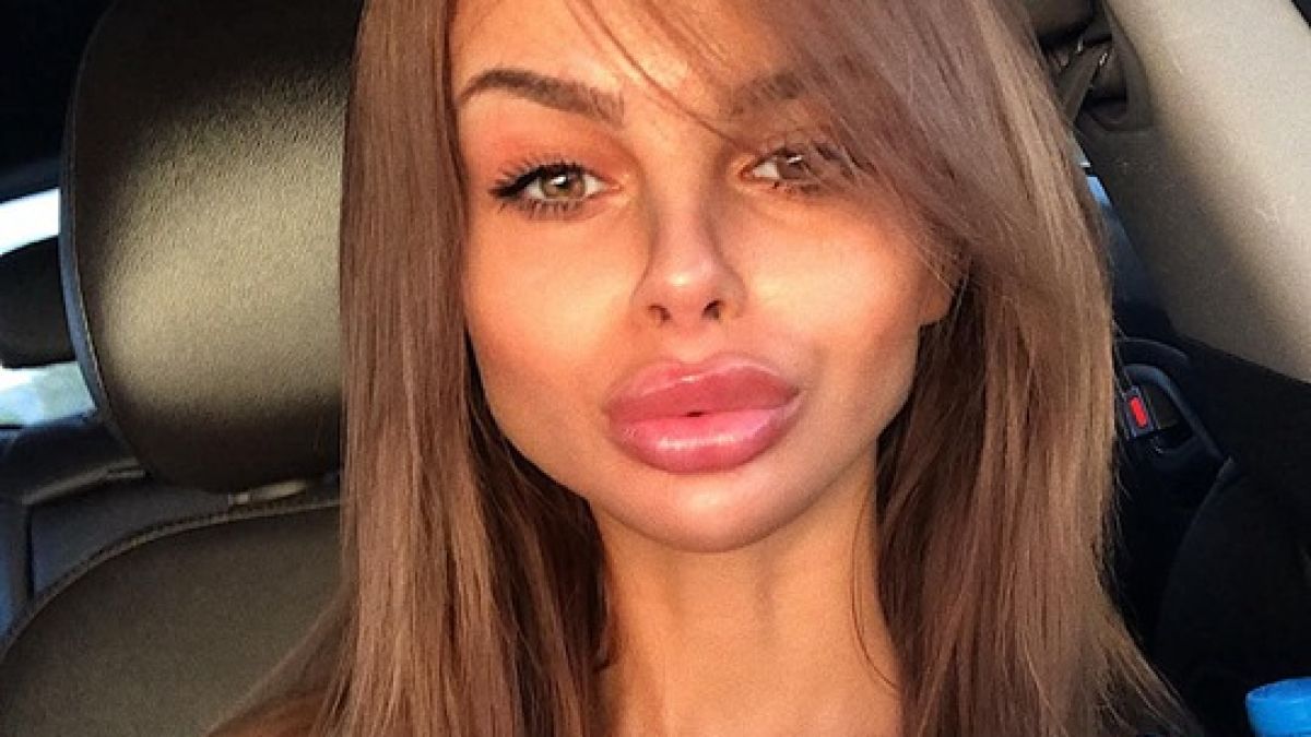 Потресаващи голи СНИМКИ 18+ на Сузанита показаха как се е обезобразила 