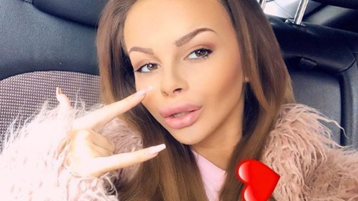 Сузанита пак легна под ножа! Този път страшно прекали! (СНИМКА 18+)