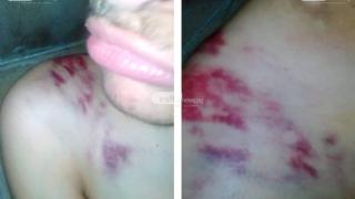 Дом на ужасите! Два смъртни случая, бой и писъци в приют за болни деца (СНИМКИ/ВИДЕО 18+)