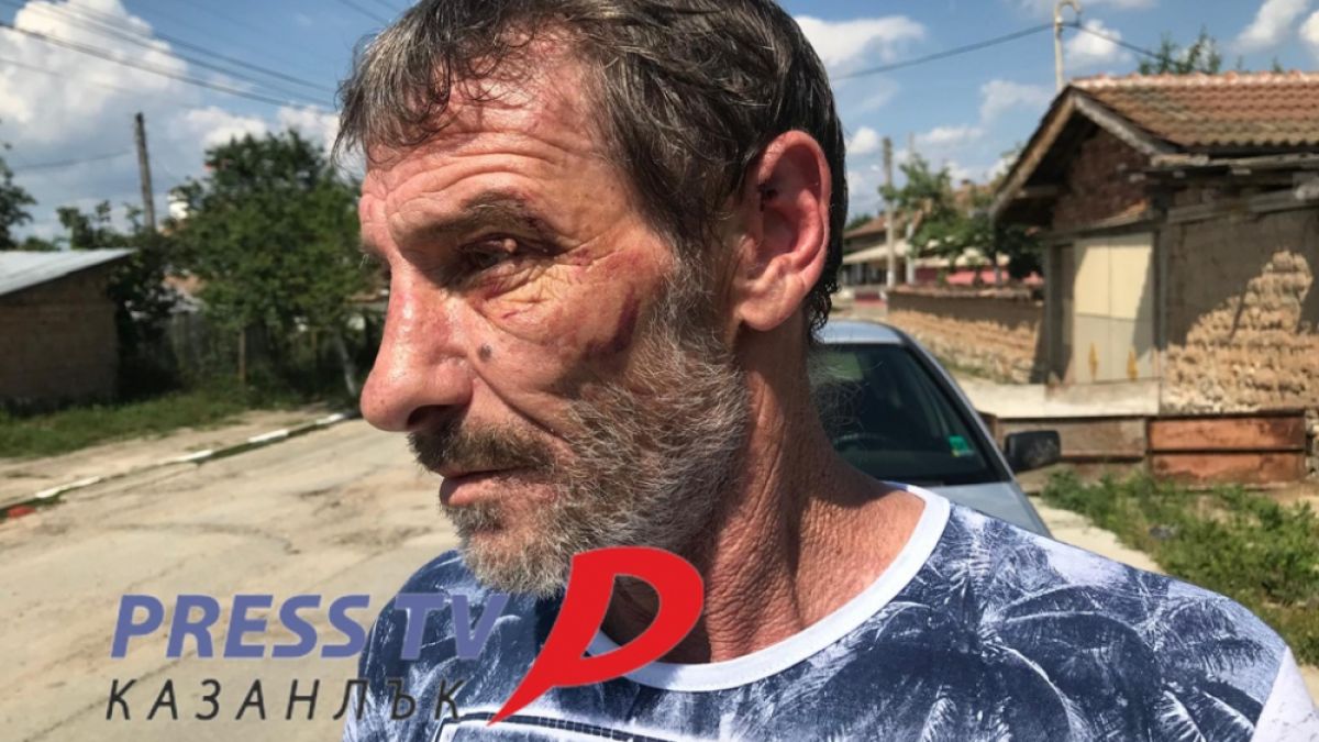 Ексклузивно: Проговори мъжът, пребит от подивели цигани на опашката в селски магазин (ВИДЕО)