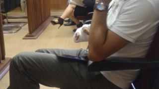 Прокопиев мълчи гузно за новото обвинение, Трайчо Трайков счупил ръка (СНИМКА)