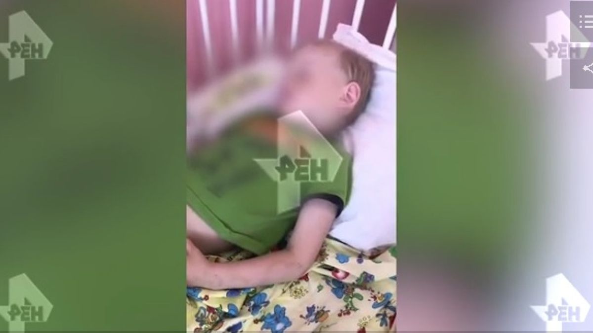 Момченце разказа как пияната му майка го нахапала и пребила 