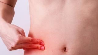 Това са симптомите на предстоящ апендицит и какво го причинява