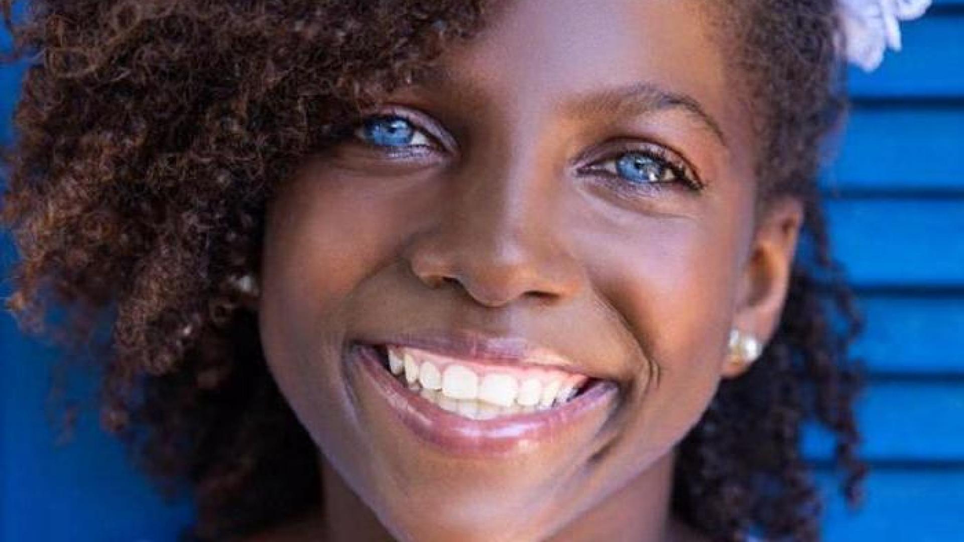 Уникални СНИМКИ на хора, надарени с необикновена външност 