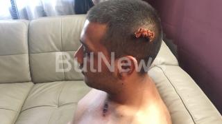  Опит за убийство в парк във Враца! КЪРВАВИ СНИМКИ 18 +