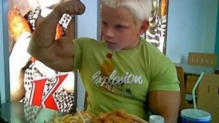 Момченце има мускули на културист, но всъщност е жертва на рядка, генетична мутация