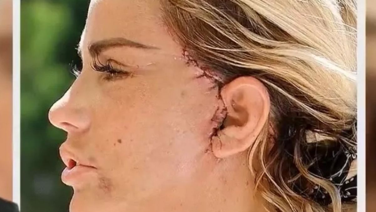 Топ модел се превърна в чудовище след пластична операция ВИДЕО 18+