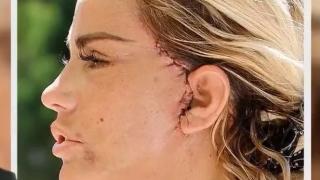 Топ модел се превърна в чудовище след пластична операция ВИДЕО 18+