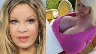Потресаващи СНИМКИ 18+ на жената с най-много пластични операции