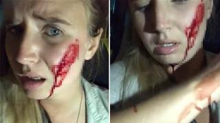 Активистка за правата на животните задигна зайци и беше наказана брутално СНИМКИ 