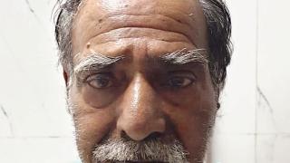 Отрязаха 10-см "рог на дявола" от главата на мъж СНИМКИ 18+