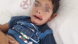 Роднини на блъснато от джип дете твърдят, че случаят се покрива, защото не било българче СНИМКИ