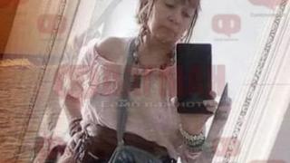 Пламналата жива жена сензор Мая Попова се нуждае от спешна помощ