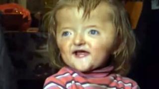 Абсурд: Ясла не иска 2-годишната София, била много грозна СНИМКИ