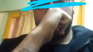 Мъж си "изтри" татуировката с ренде СНИМКИ 18+