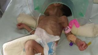 Почернени родители спасиха 3-дневно бебе, погребано живо в делва ВИДЕО 