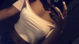 Как #nobraday помага в борбата с рака на гърдата? СНИМКИ 18+