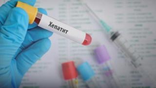 Здравната каса отмени изследване за лечение срещу хепатит С