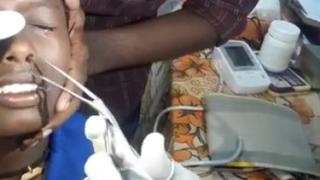 Не е за вярване какво извадиха лекари от носа на момченце ВИДЕО 