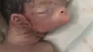 Бебе се роди със свинска зурла и уши на врата ВИДЕО