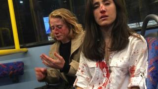 Тинейджъри наобиколиха двойка лесбийки в автобус и ги спукаха от бой ВИДЕО
