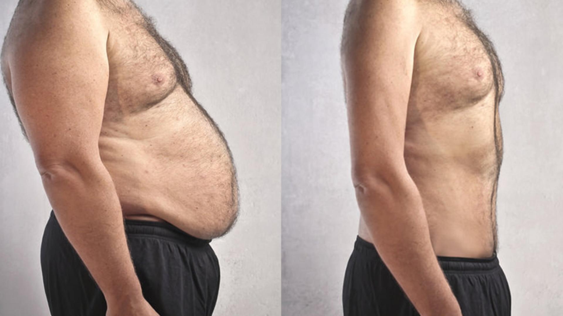 Моята трансформация: Отслабвах с по 5 кг седмично и след един месец имах мечтаната фигура