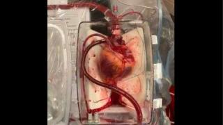  Страшно ВИДЕО 18+: US лекари извадиха сърцето на мъртвец, гледката не е за всеки 
