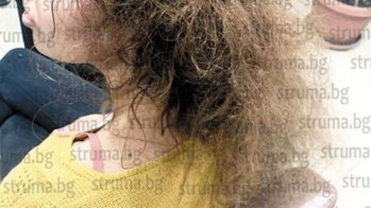Ужас! Български шампоан съсипа уникалната коса на момиче СНИМКИ