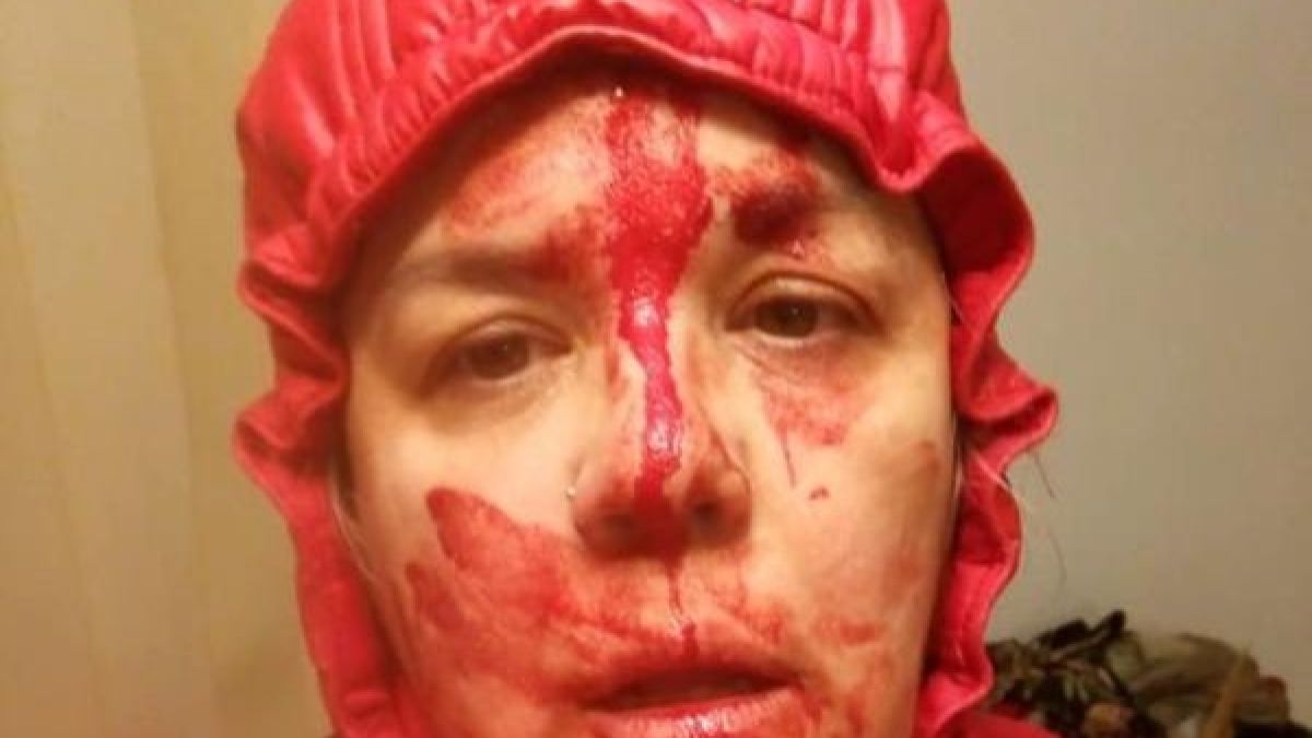 Агресивна мижитурка помля жена, извела кучето си на разходка СНИМКА 18+