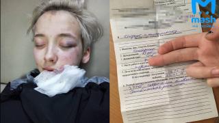 Седем мъже пребиха 18-годишна заради външния й вид ВИДЕО 18+