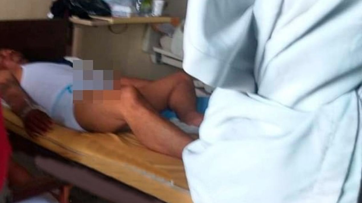 Загорял мераклия глътна виагра за бикове и стана голяма беля