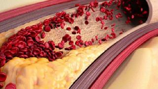 Тези три народни рецепти прочистват кръвта