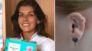 Некадърен пластичен хирург обезобрази жестоко дузина пациентки