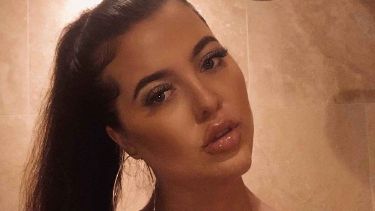 Жена с 4 гърди легна под скалпела и се раздели с 2 от тях СНИМКИ 18+
