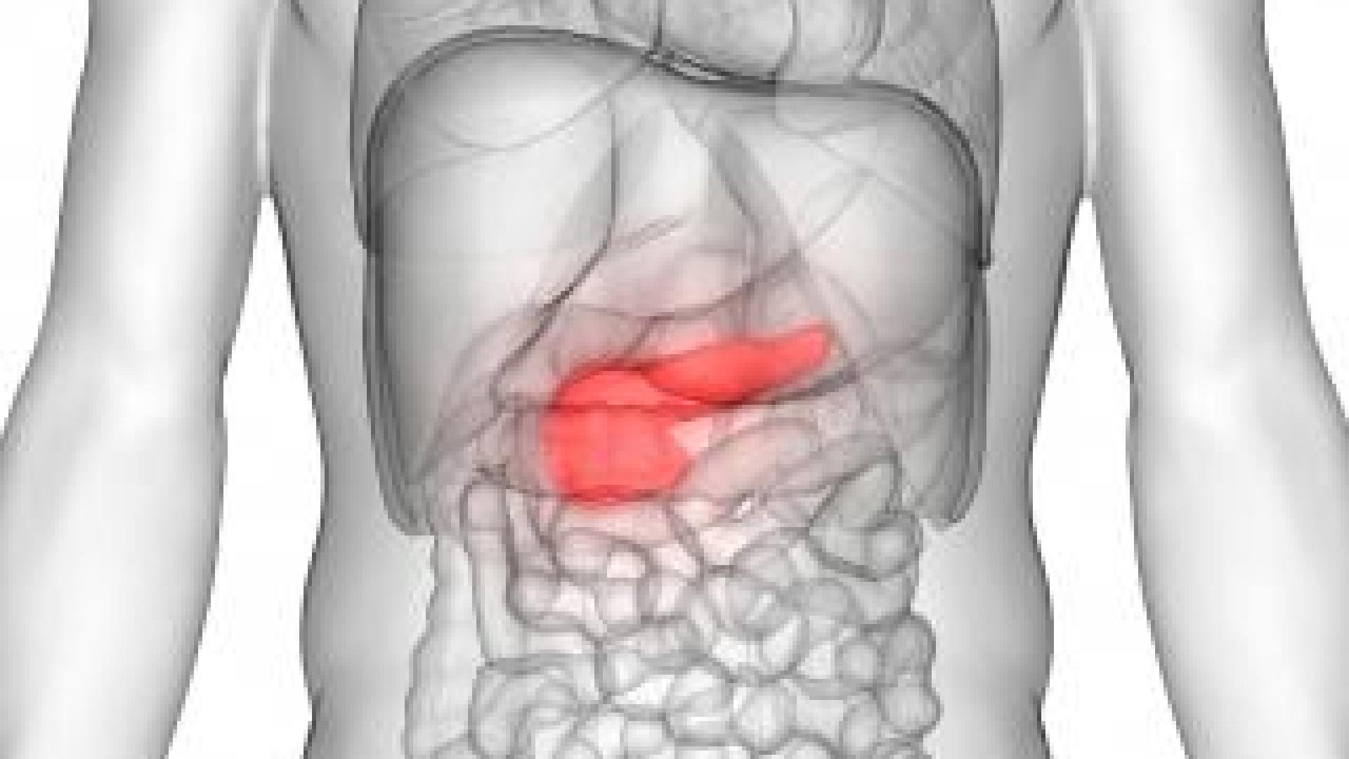Учени посочиха първия симптом за рак на панкреаса и как да го разпознаем