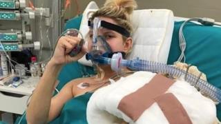 Автобус откъсна ръката на сръбска ТВ водеща, пришиха й я успешно
