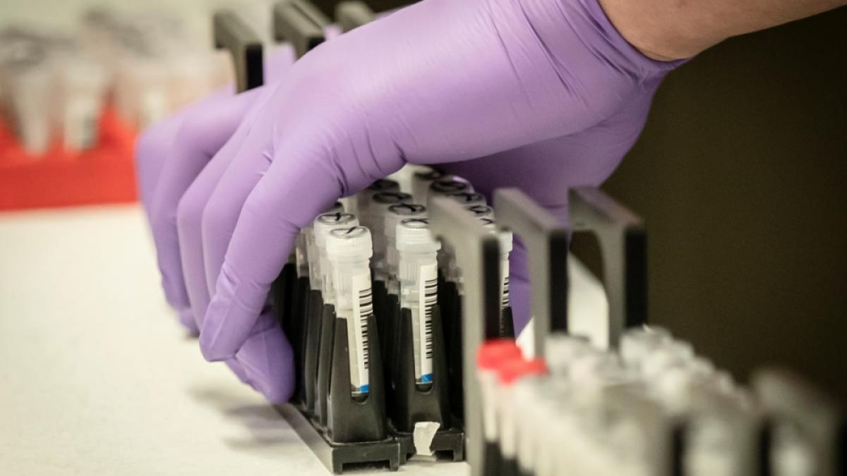 Японско лекарство е ефективно при лечението на коронавирус, доказа го тест с пациенти 
