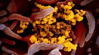 Сп. Nature: US биолози създали коронавирус убиец още през 2015 г.