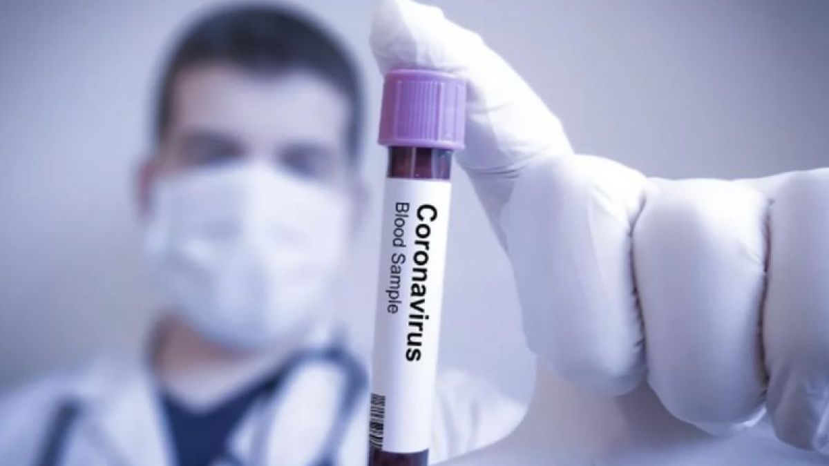 Германски вирусолози посочиха единственото спасение от COVID-19