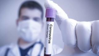Германски вирусолози посочиха единственото спасение от COVID-19