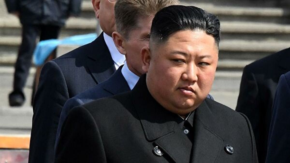 Ким Чен Ун изпаднал в кома заради треперещите ръце на хирурга