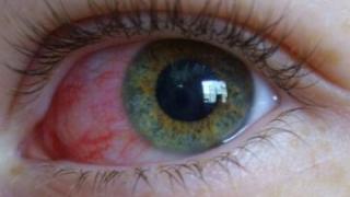 Зловеща новина за очите и COVID-19